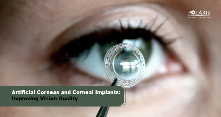 Artificial Corneas and Corneal Implants: Improving Vision Quality